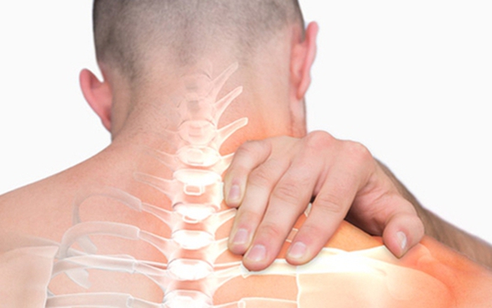 Giải đáp 6 thắc mắc phổ biến về hội chứng đầu cổ và cách điều trị