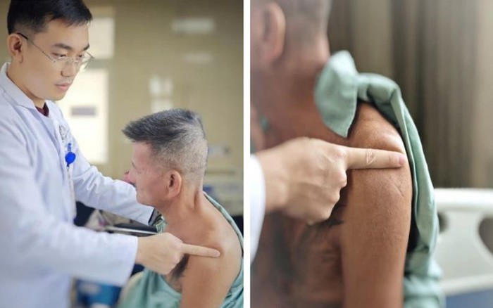 60 Tuổi Thoát Di Chứng Đột Quỵ Nhờ Kiên Trì Tập Luyện 3 Tháng